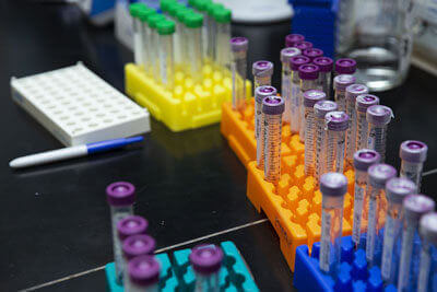 Härtegrad des Wassers: ungesund oder unwichtig?